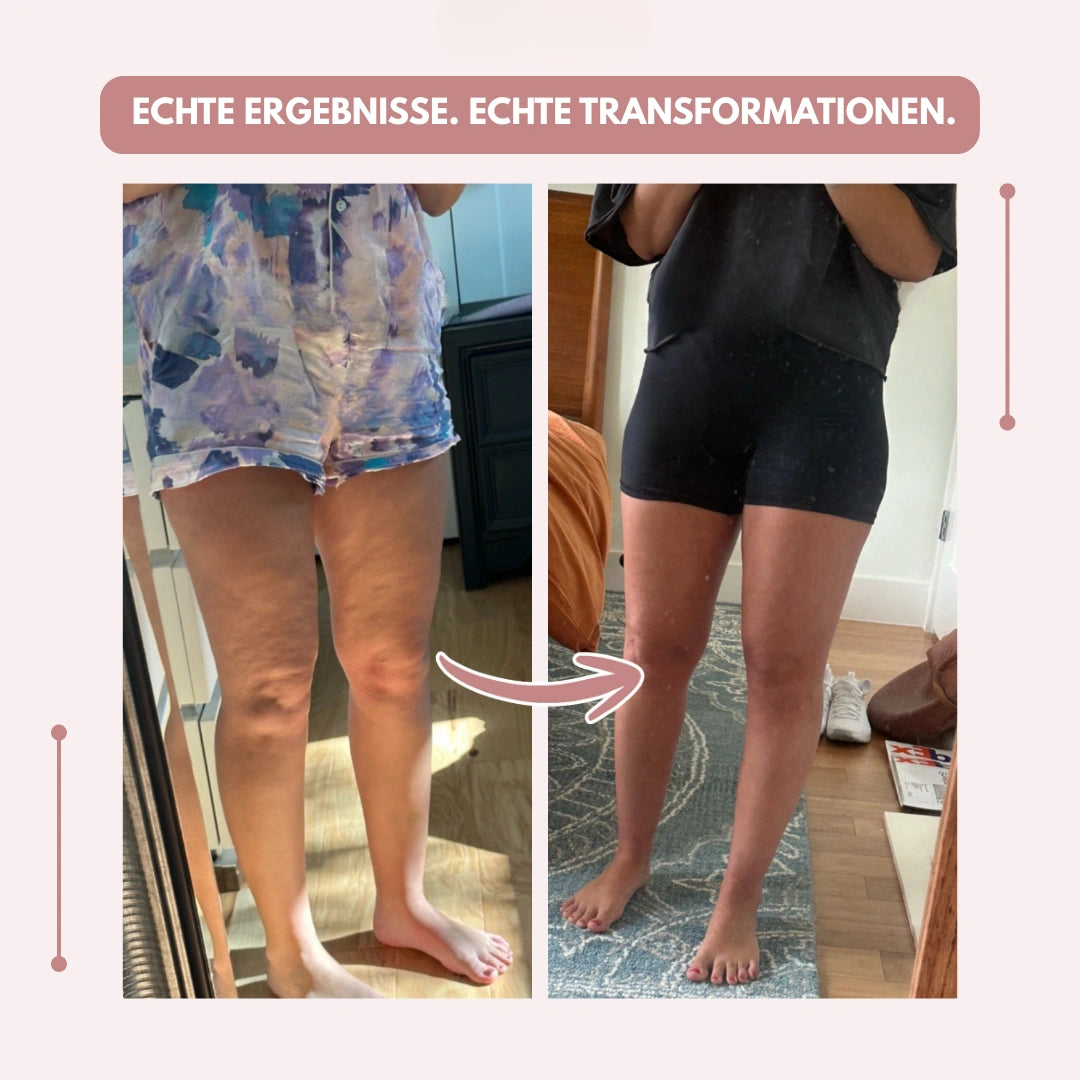 Vorher-nachher-Spiegelselfies der Beine einer Frau, links in gemusterten Shorts, rechts in schwarzer enger Shorts. 19