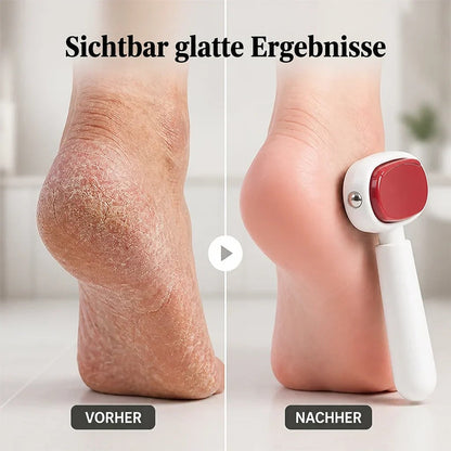 Vorher-Nachher-Vergleich: raue, rissige Ferse links, glatte Ferse rechts mit aufgesetzter Fußfeile 2