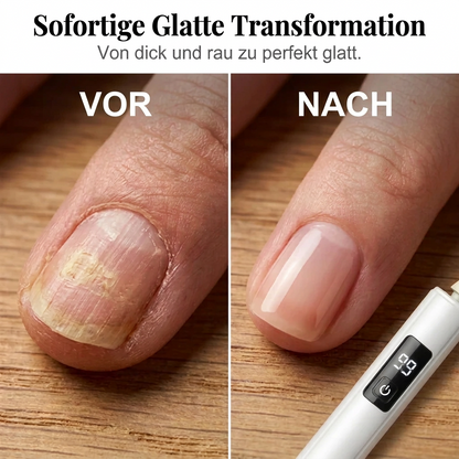 Elektrisches Präzisions Nagelpflegeset mit 4 Aufsätzen